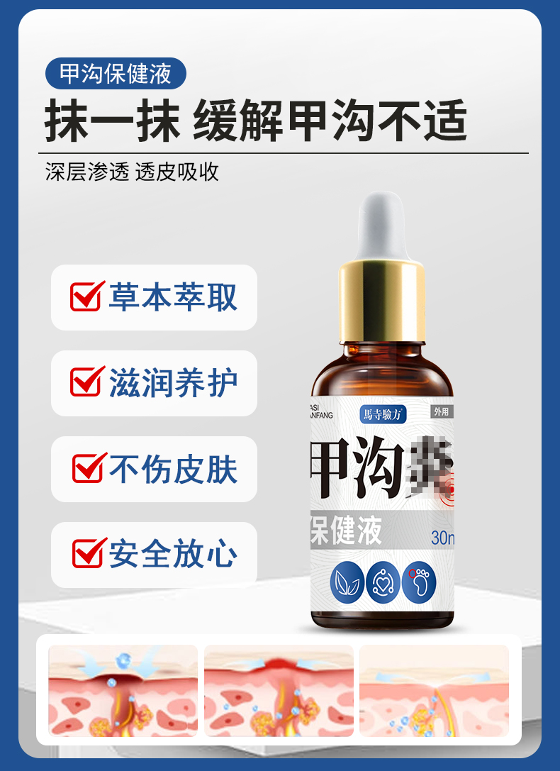 抹一抹，緩解甲溝不適